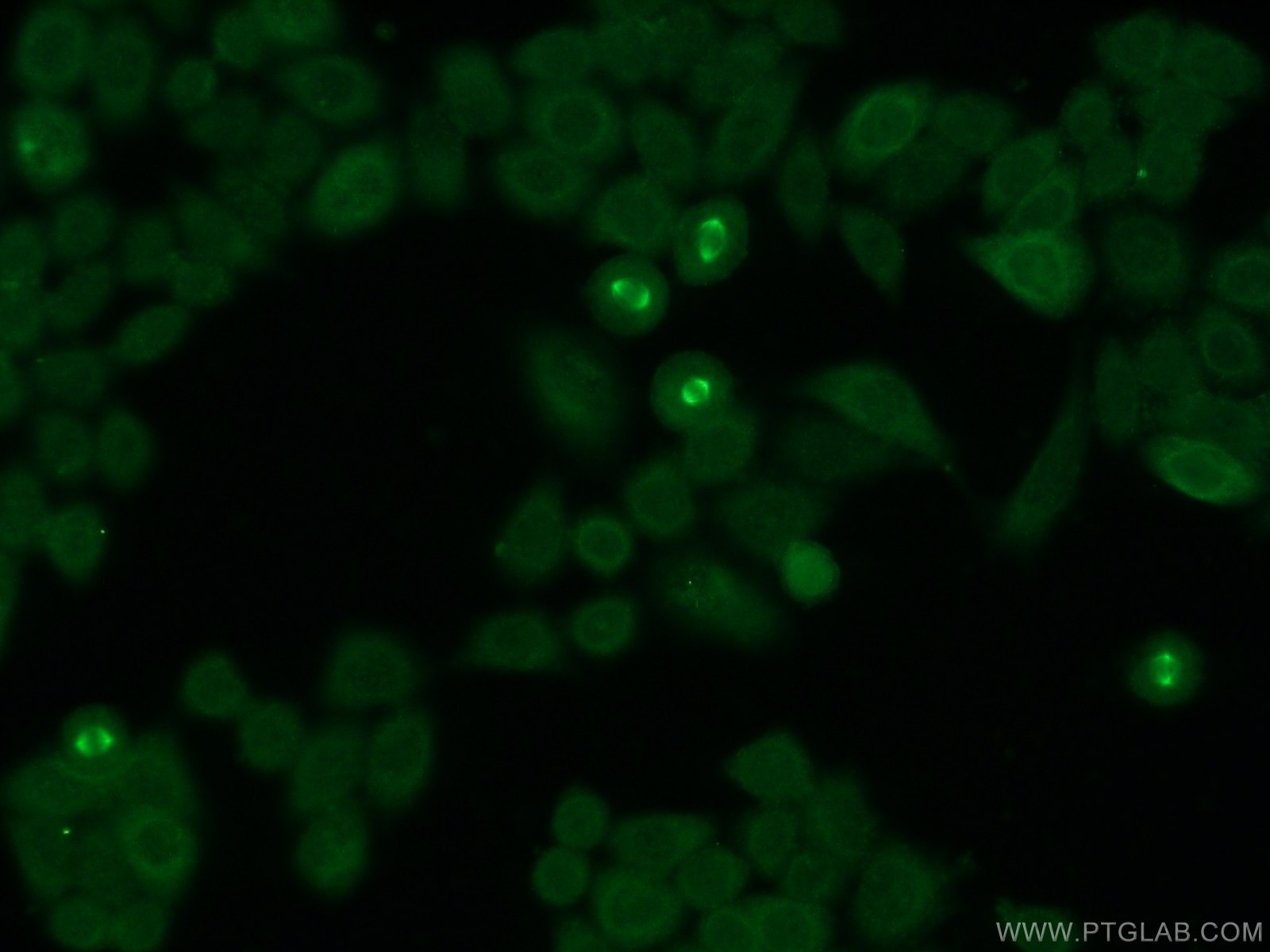 Immunofluorescence (IF) / fluorescent staining of HeLa cells using CKAP2 Polyclonal antibody (25486-1-AP)