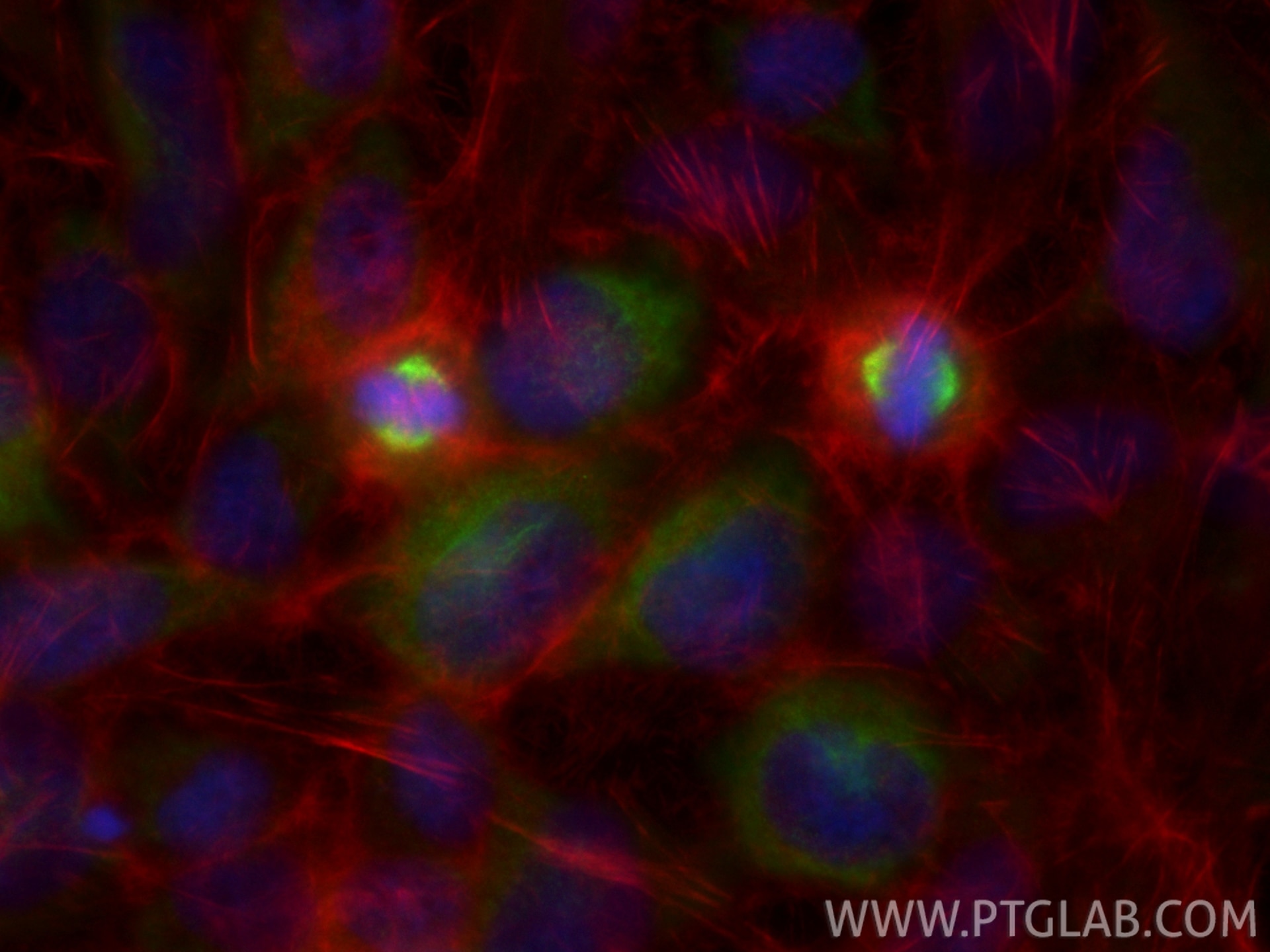 Immunofluorescence (IF) / fluorescent staining of HeLa cells using CKAP2 Polyclonal antibody (25486-1-AP)