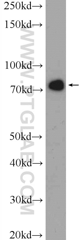 Western Blot (WB) analysis of HeLa cells using CKAP2 Polyclonal antibody (25486-1-AP)