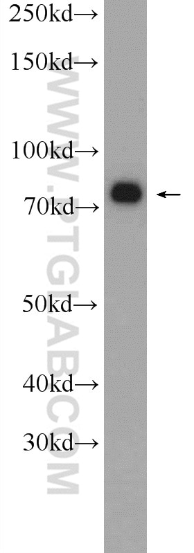 Western Blot (WB) analysis of HEK-293 cells using CKAP2 Polyclonal antibody (25486-1-AP)