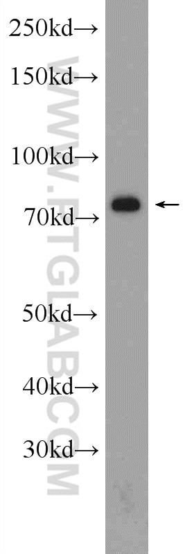 Western Blot (WB) analysis of PC-3 cells using CKAP2 Polyclonal antibody (25486-1-AP)