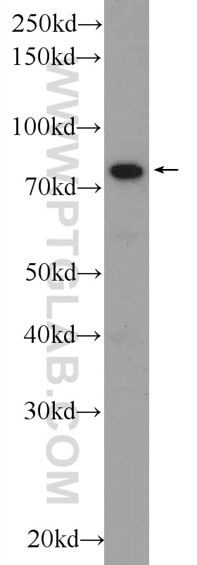 WB analysis of SGC-7901 using 25486-1-AP