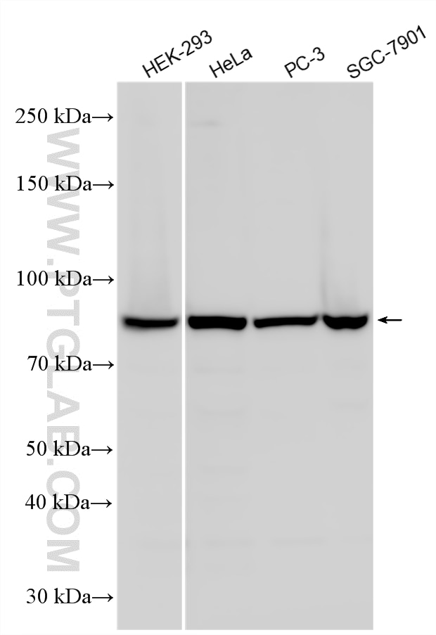 Various lysates were subjected to SDS PAGE followed by western blot with 25486-1-AP (CKAP2 antibody) at dilution of 1:4000 incubated at room temperature for 1.5 hours. Western Blot (WB) analysis of various lysates using CKAP2 Polyclonal antibody (25486-1-AP)