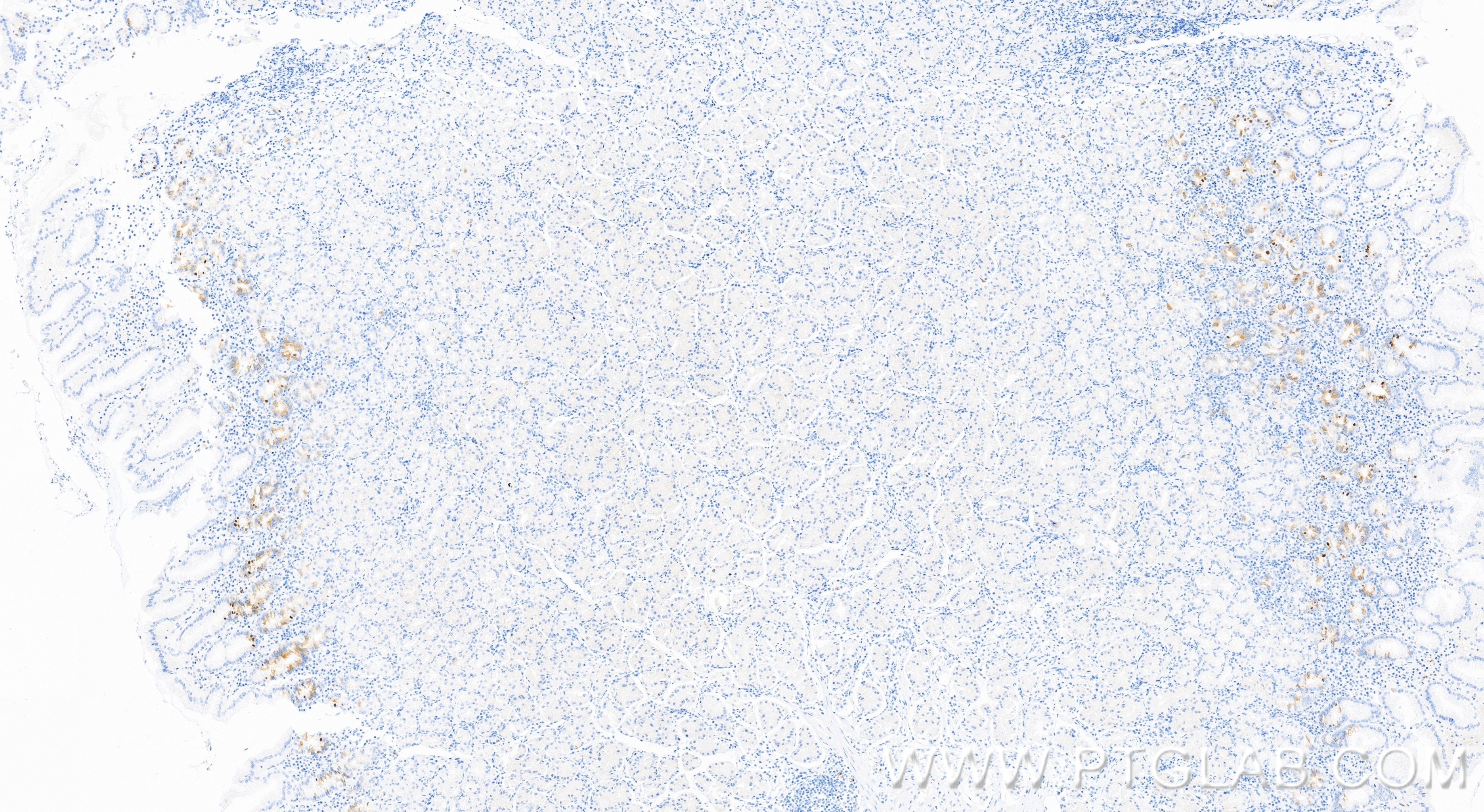 IHC staining of human stomach using 86689-1-RR Immunohistochemistry (IHC) staining of human stomach tissue using CKAP2 Recombinant monoclonal antibody (86689-1-RR)