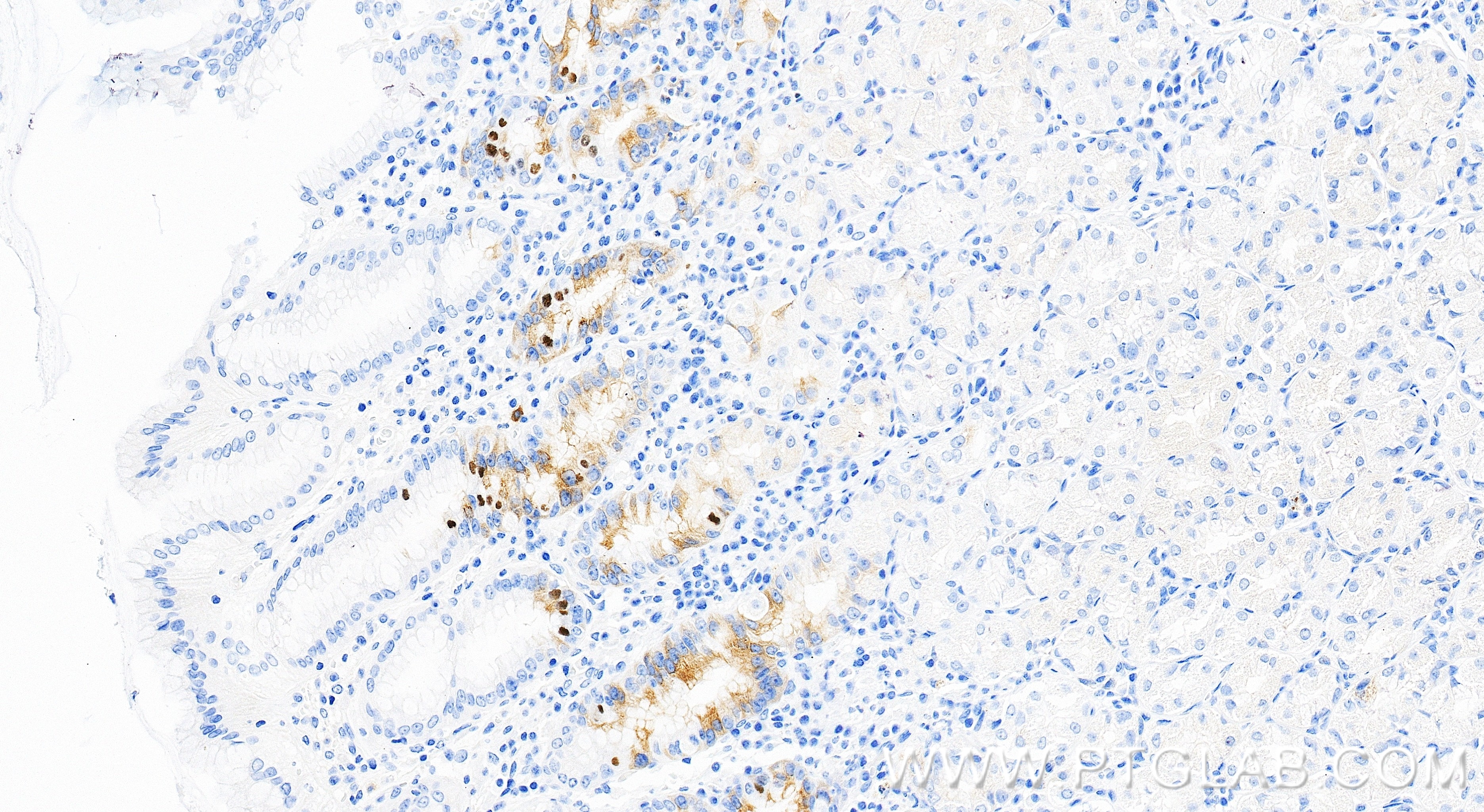 IHC staining of human stomach using 86689-1-RR Immunohistochemistry (IHC) staining of human stomach tissue using CKAP2 Recombinant monoclonal antibody (86689-1-RR)