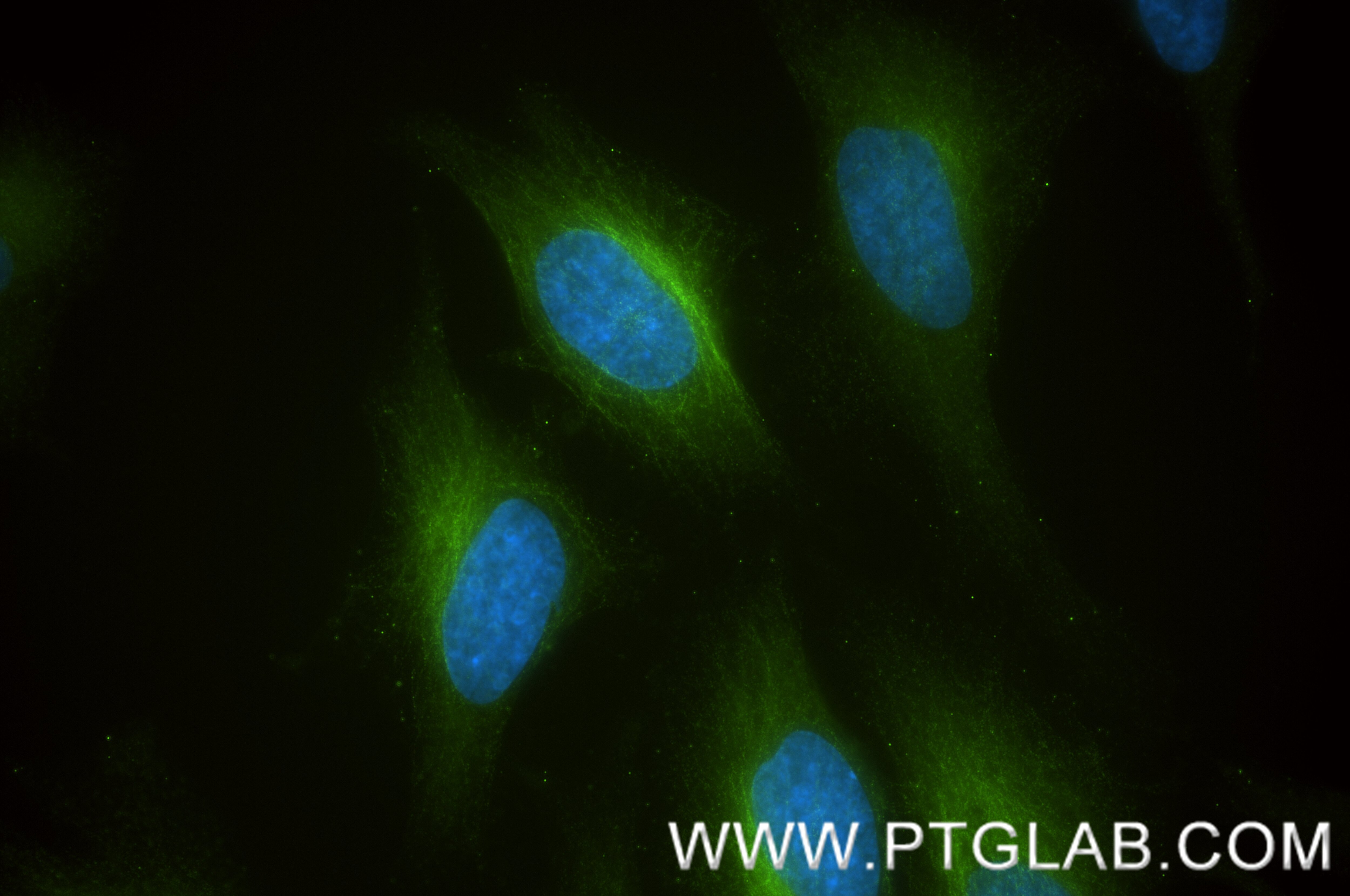 IF Staining of HeLa using 86689-1-RR Immunofluorescence (IF) / fluorescent staining of HeLa cells using CKAP2 Recombinant monoclonal antibody (86689-1-RR)