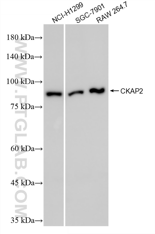 WB analysis using 86689-1-RR Western Blot (WB) analysis of various lysates using CKAP2 Recombinant monoclonal antibody (86689-1-RR)