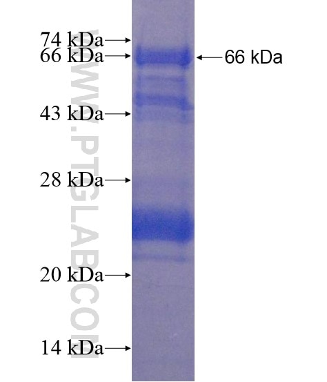 CKAP2 fusion protein Ag21901 SDS-PAGE