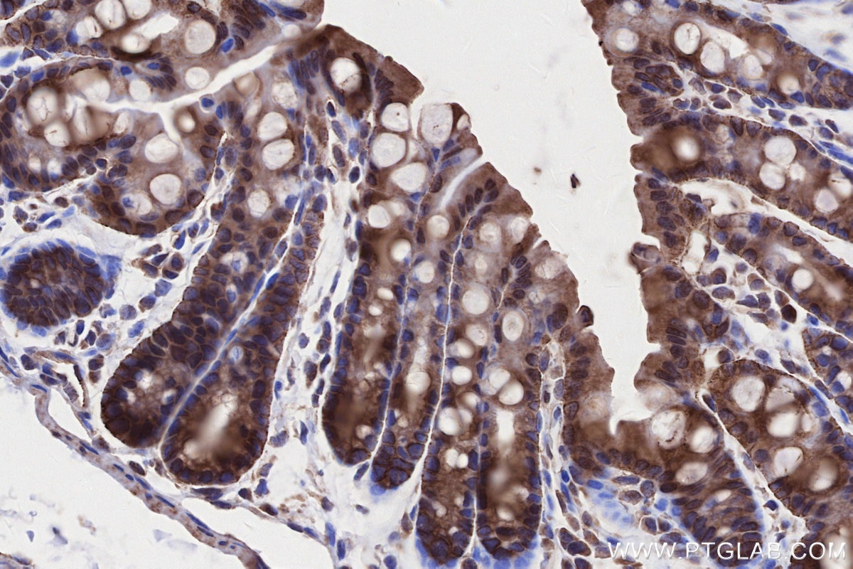 Immunohistochemistry (IHC) staining of mouse colon tissue using CKAP2L Polyclonal antibody (17143-1-AP)
