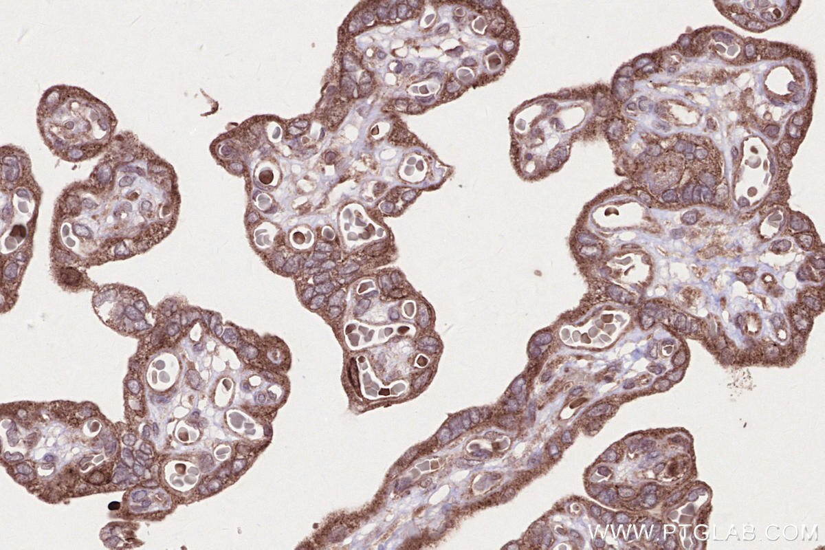 Immunohistochemistry (IHC) staining of human placenta tissue using CKAP2L Polyclonal antibody (17143-1-AP)