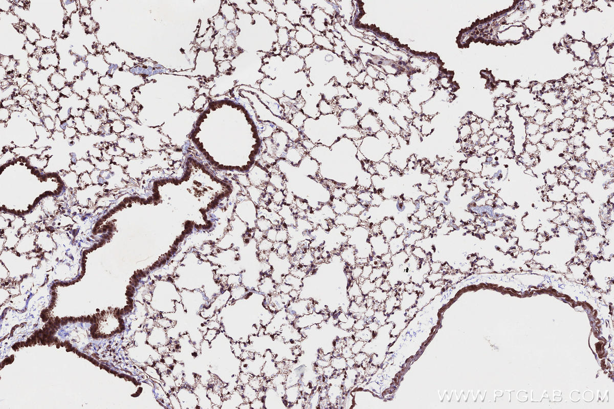 Immunohistochemistry (IHC) staining of mouse lung tissue using CKAP2L Polyclonal antibody (17143-1-AP)