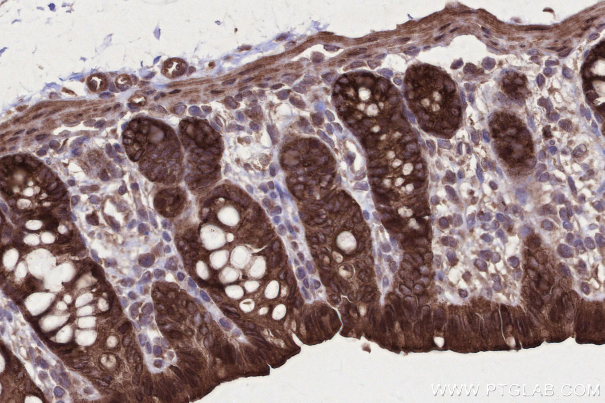 Immunohistochemistry (IHC) staining of rat colon tissue using CKAP2L Polyclonal antibody (17143-1-AP)