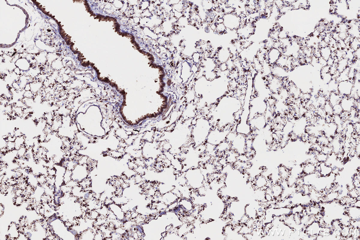 Immunohistochemistry (IHC) staining of rat lung tissue using CKAP2L Polyclonal antibody (17143-1-AP)