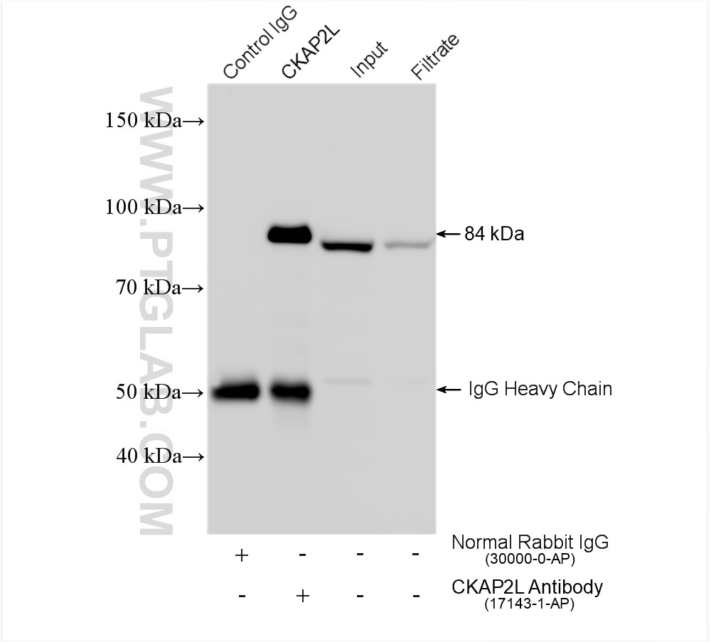 Immunoprecipitation (IP) experiment of Jurkat cells using CKAP2L Polyclonal antibody (17143-1-AP)