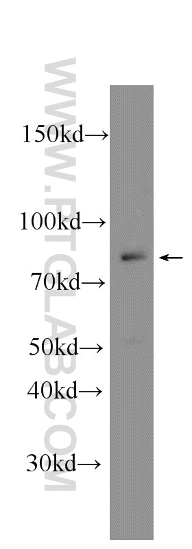 Western Blot (WB) analysis of K-562 cells using CKAP2L Polyclonal antibody (17143-1-AP)