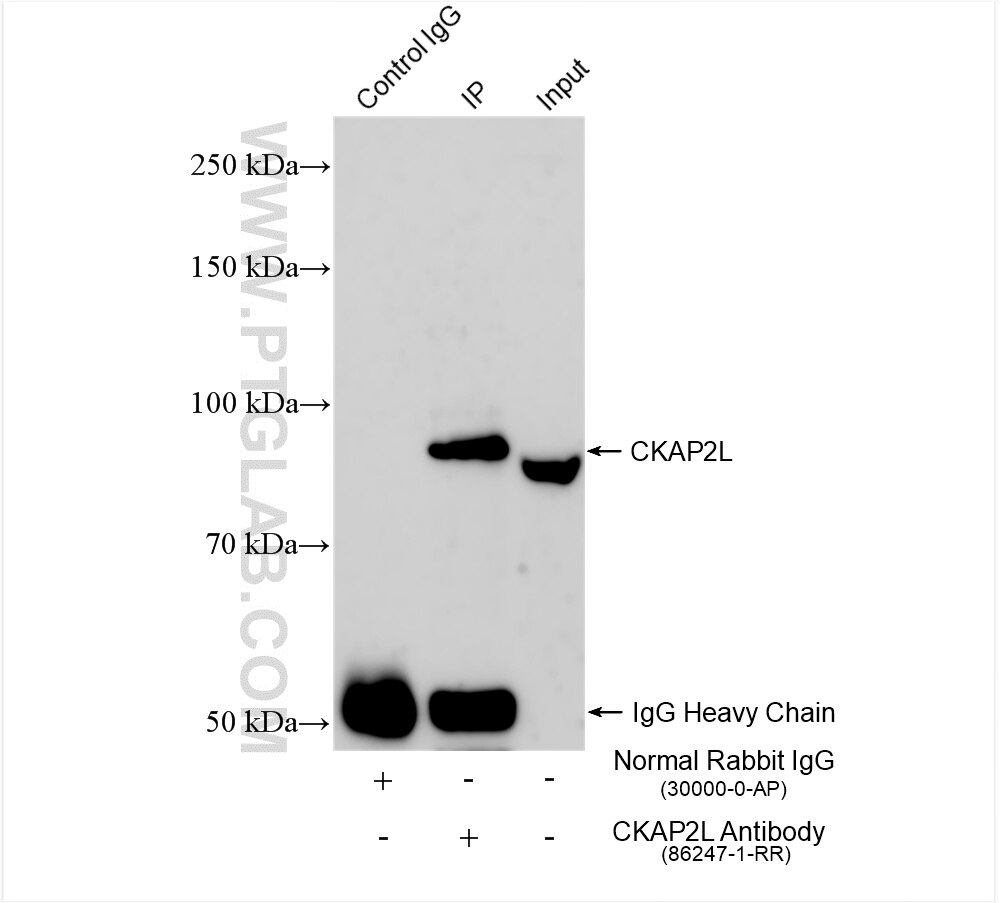Immunoprecipitation (IP) experiment of Jurkat cells using CKAP2L Recombinant antibody (86247-1-RR)