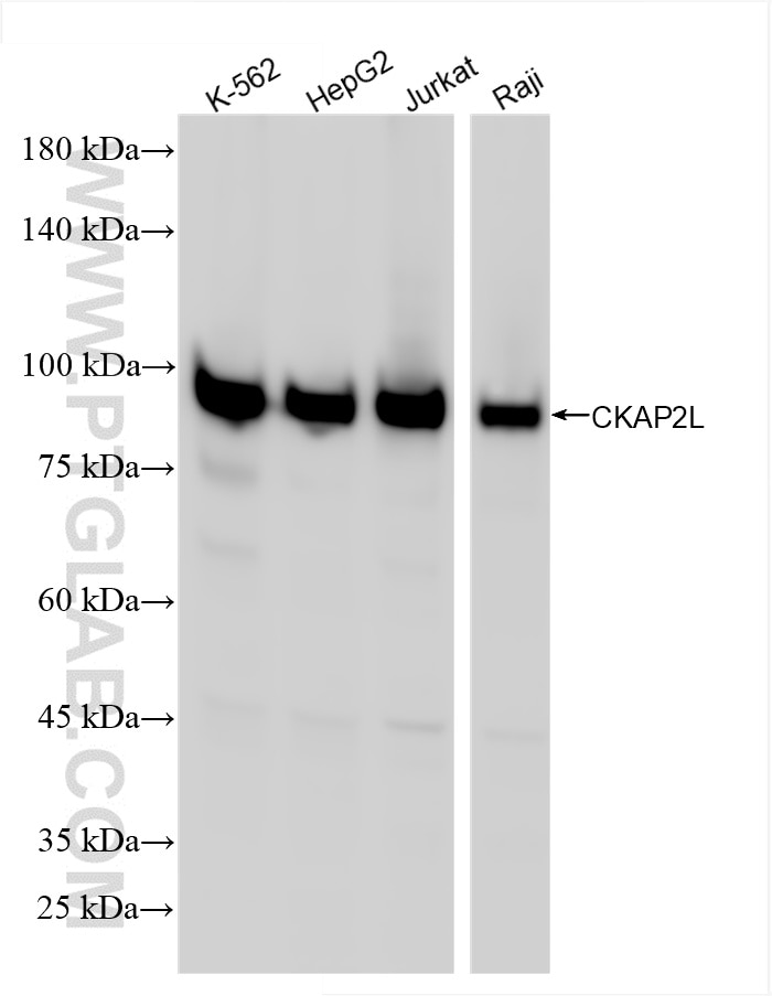 Western Blot (WB) analysis of various lysates using CKAP2L Recombinant antibody (86247-1-RR)