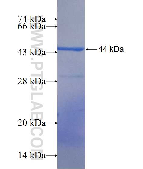 CKAP2L fusion protein Ag10861 SDS-PAGE