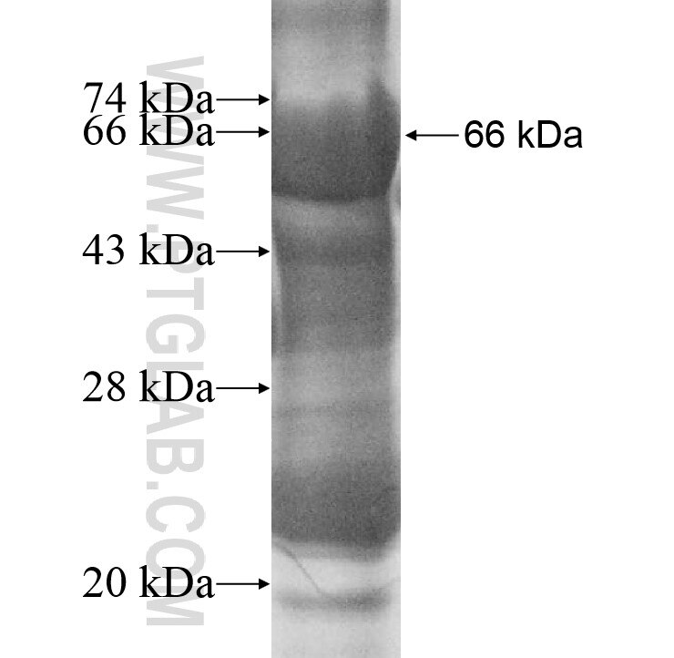 CKAP2L fusion protein Ag10909 SDS-PAGE
