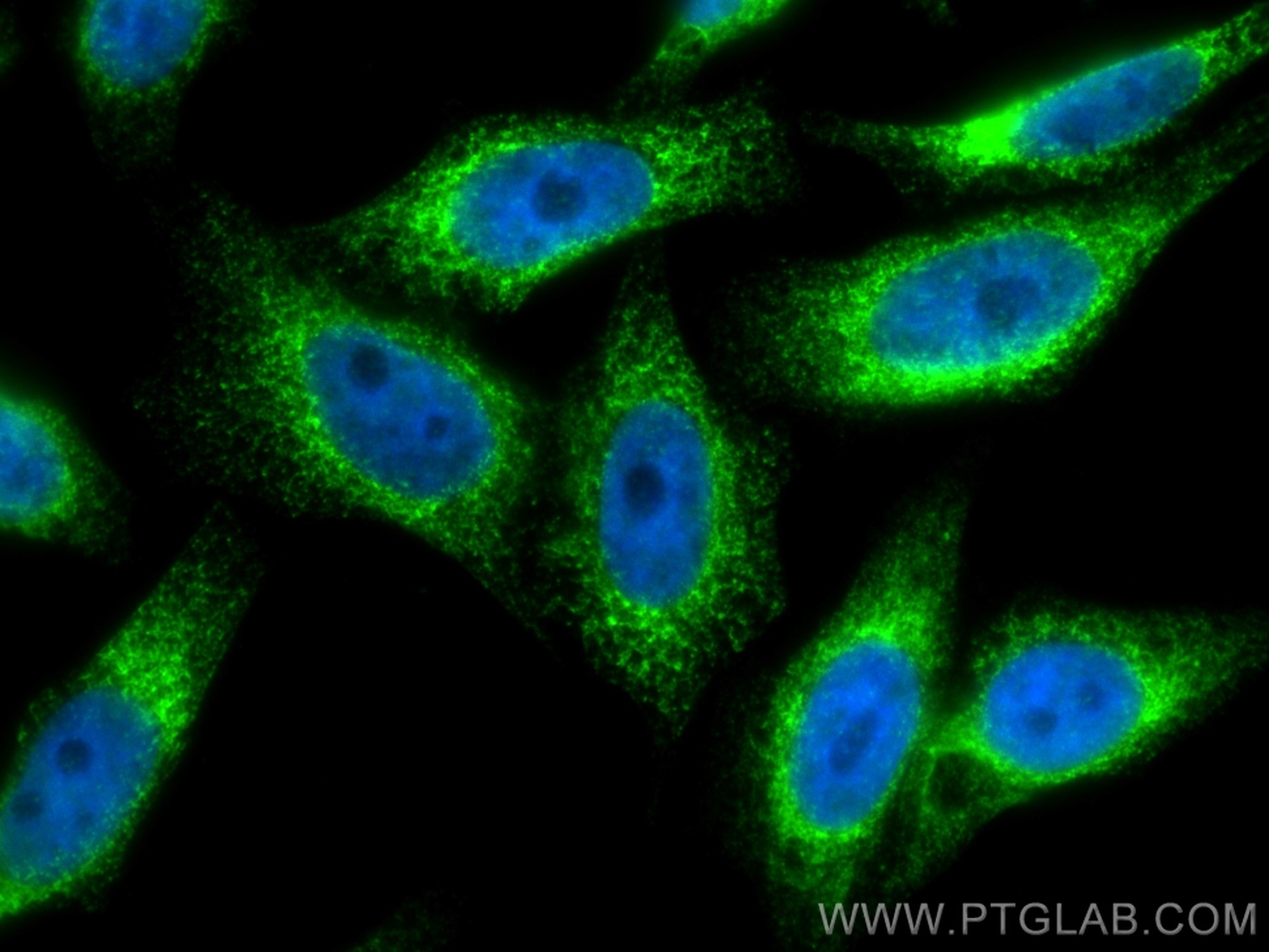 Immunofluorescence (IF) / fluorescent staining of HepG2 cells using CKAP4 Polyclonal antibody (16686-1-AP)