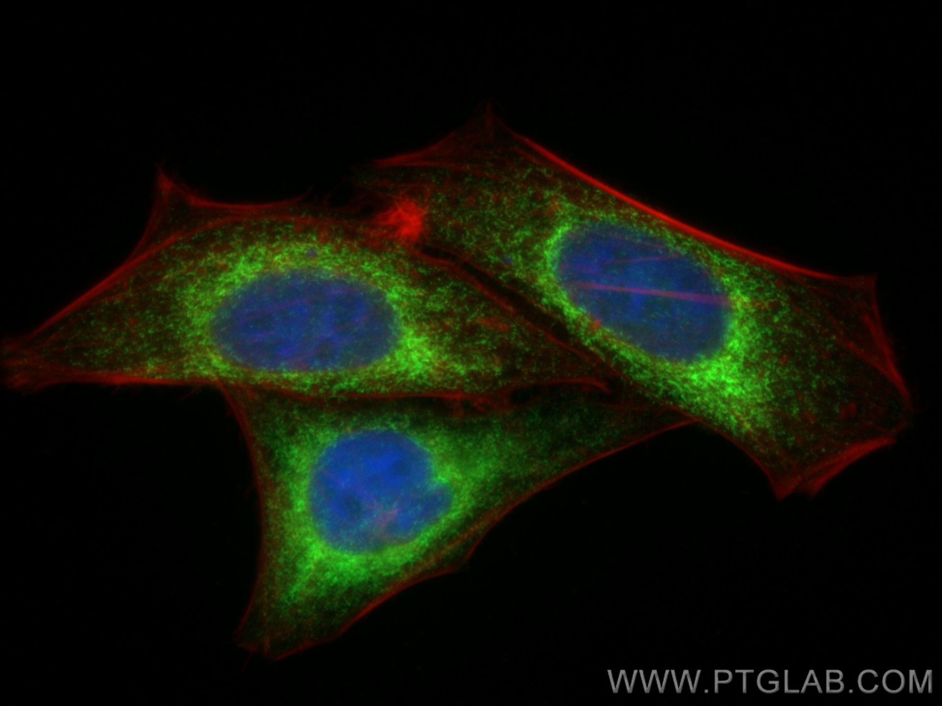 Immunofluorescence (IF) / fluorescent staining of HepG2 cells using CKAP4 Polyclonal antibody (16686-1-AP)