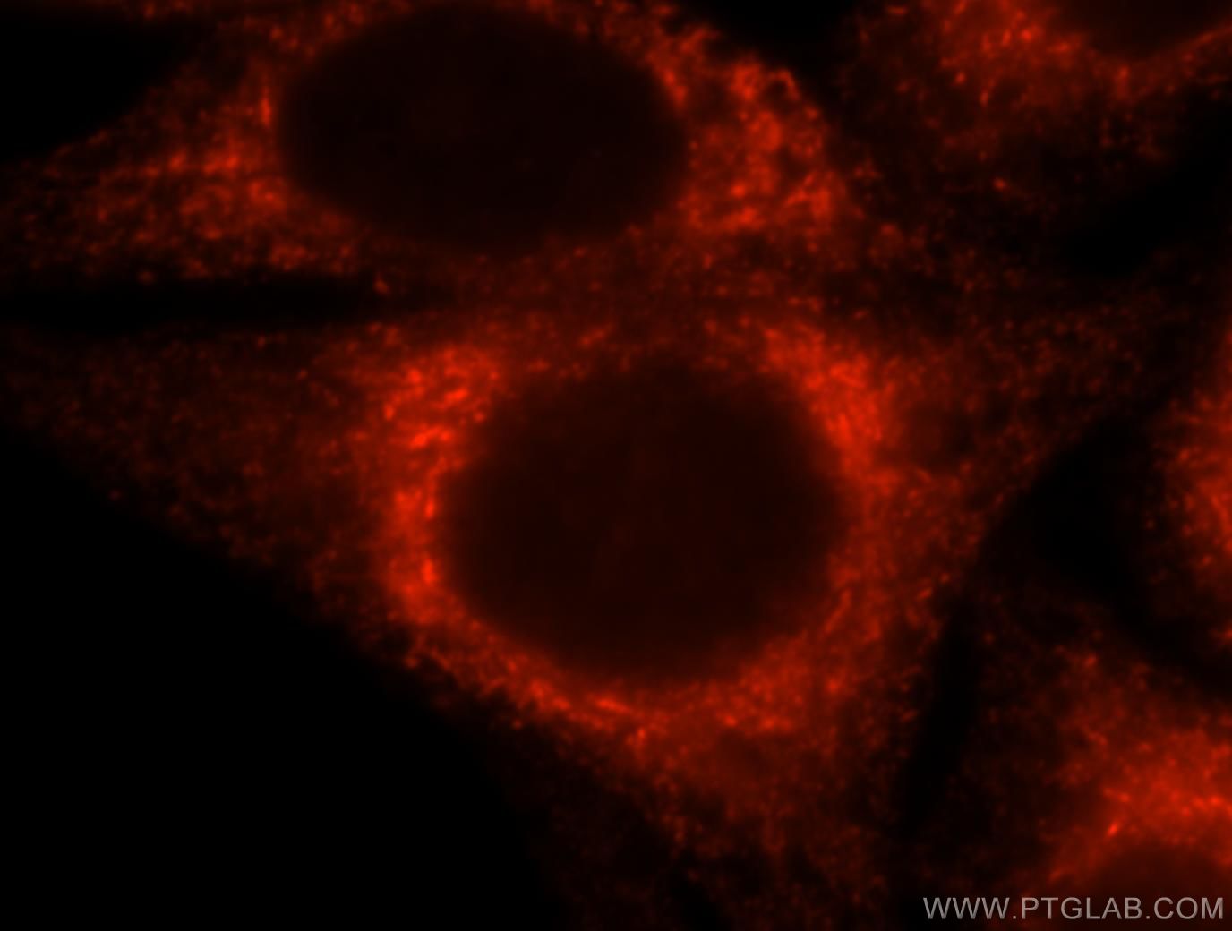Immunofluorescence (IF) / fluorescent staining of HepG2 cells using CKAP4 Polyclonal antibody (16686-1-AP)