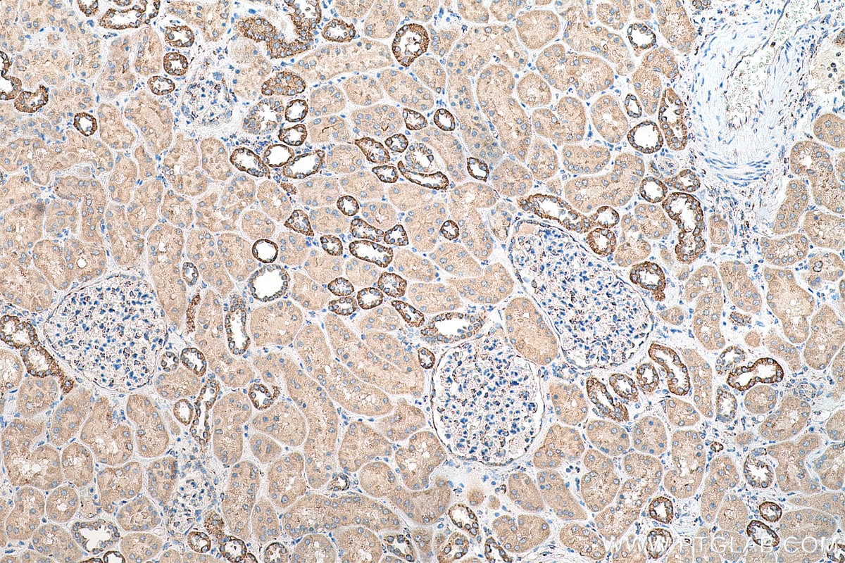 Immunohistochemistry (IHC) staining of human kidney tissue using CKAP4 Polyclonal antibody (16686-1-AP)