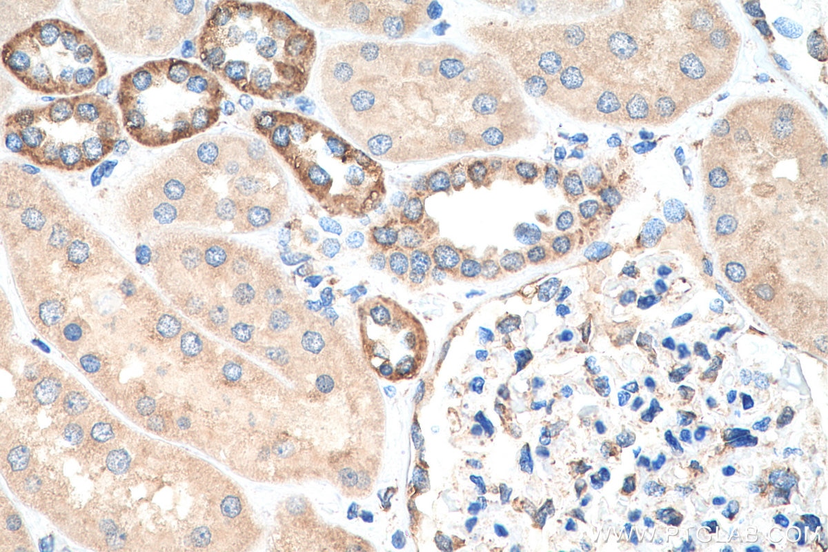 Immunohistochemistry (IHC) staining of human kidney tissue using CKAP4 Polyclonal antibody (16686-1-AP)