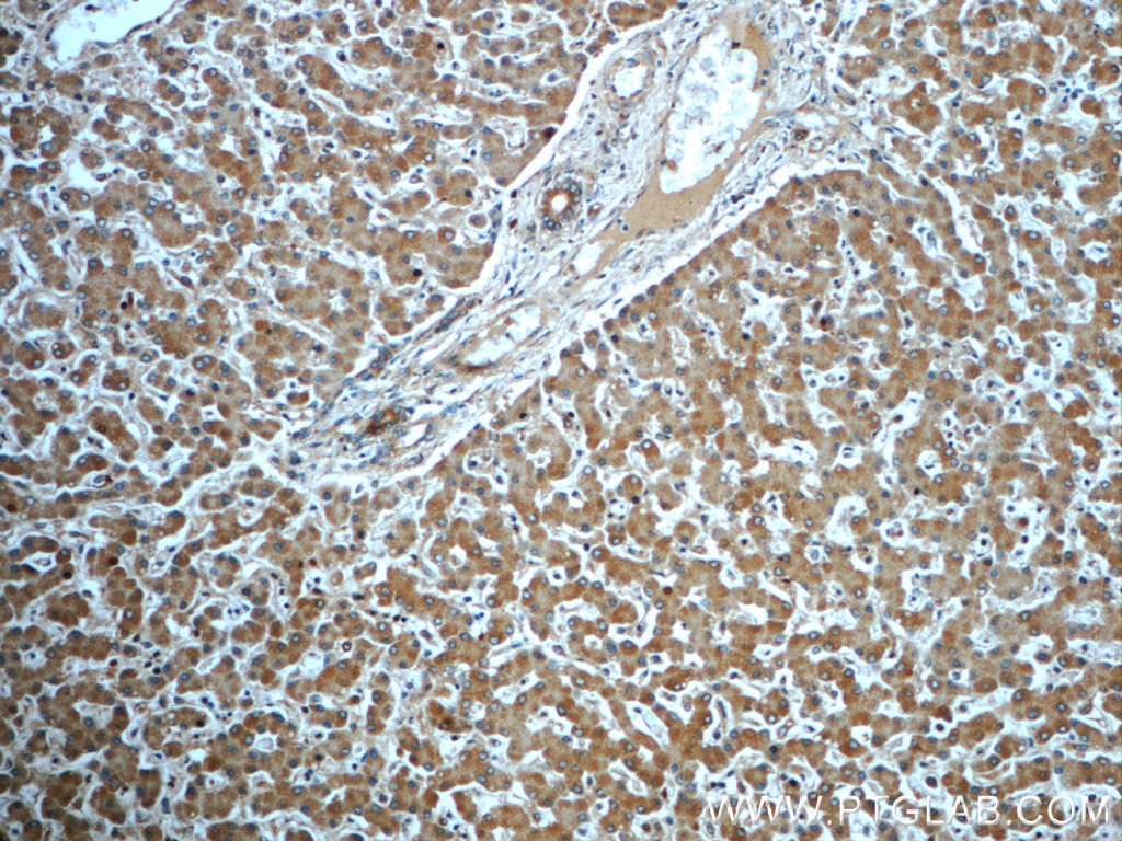 IHC staining of human liver using 16686-1-AP