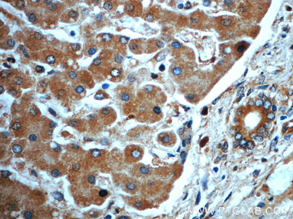 Immunohistochemistry (IHC) staining of human liver tissue using CKAP4 Polyclonal antibody (16686-1-AP)