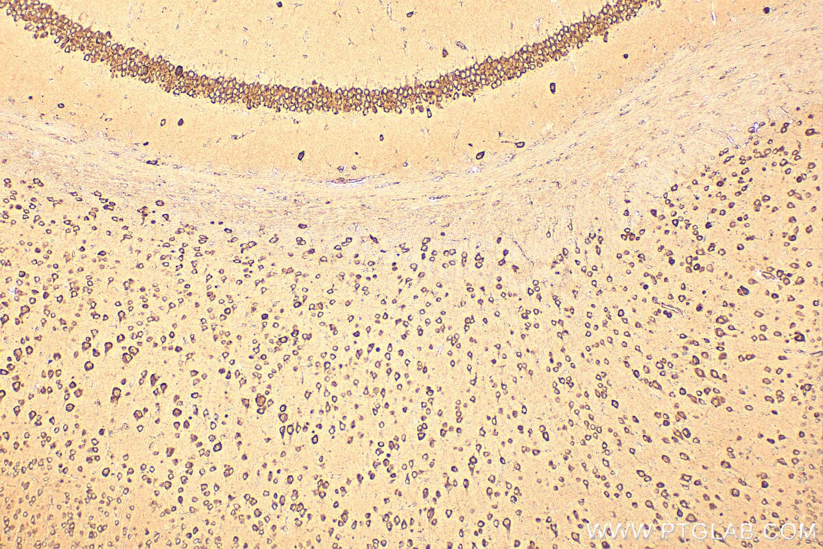 Immunohistochemistry (IHC) staining of mouse brain tissue using CKAP4 Polyclonal antibody (16686-1-AP)