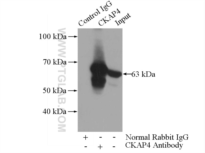 Immunoprecipitation (IP) experiment of HeLa cells using CKAP4 Polyclonal antibody (16686-1-AP)