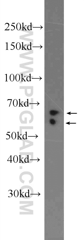 Western Blot (WB) analysis of rat kidney tissue using CKAP4 Polyclonal antibody (16686-1-AP)