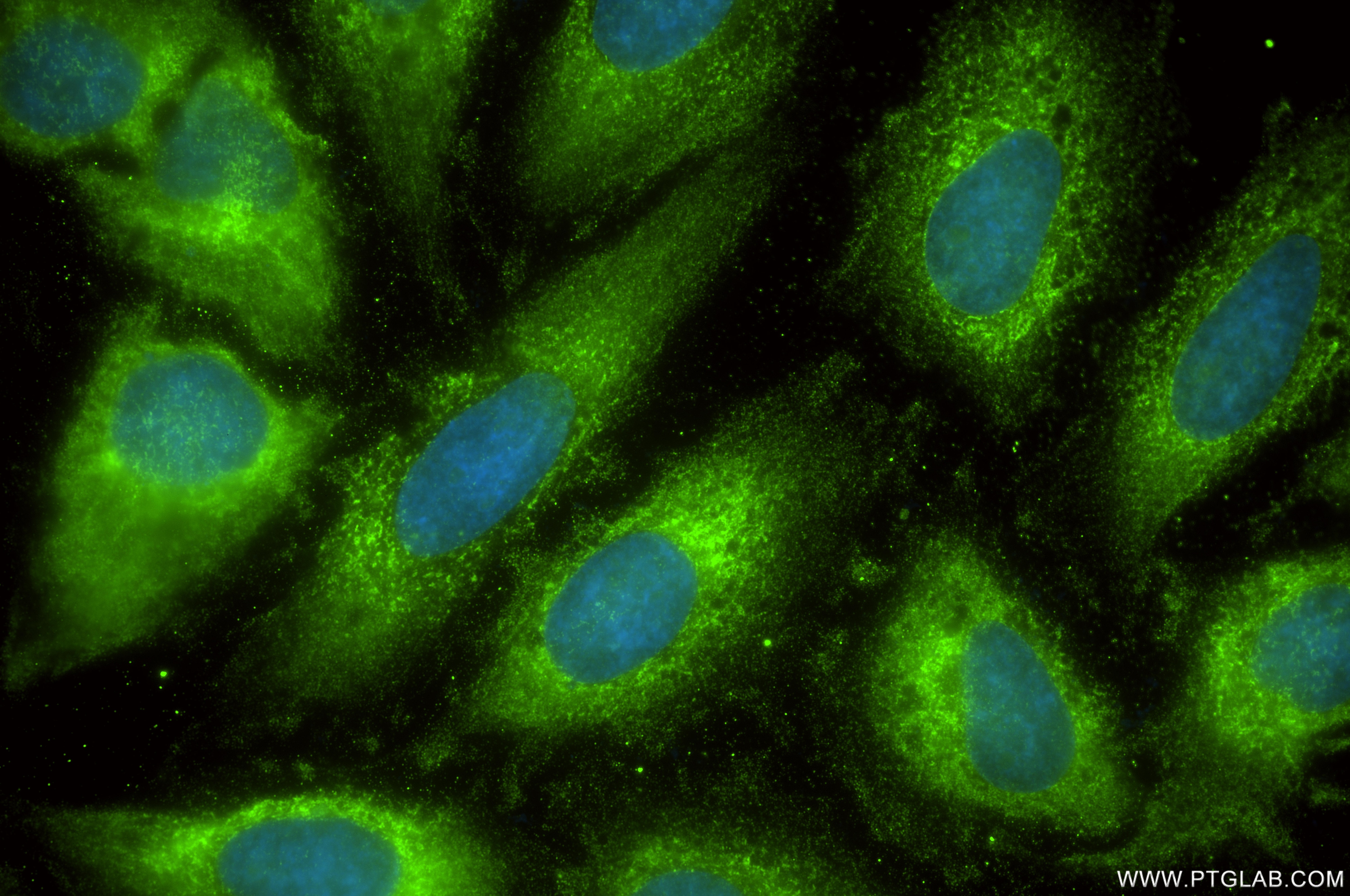 Immunofluorescence (IF) / fluorescent staining of HeLa cells using CKAP4 Recombinant monoclonal antibody (84485-5-RR)