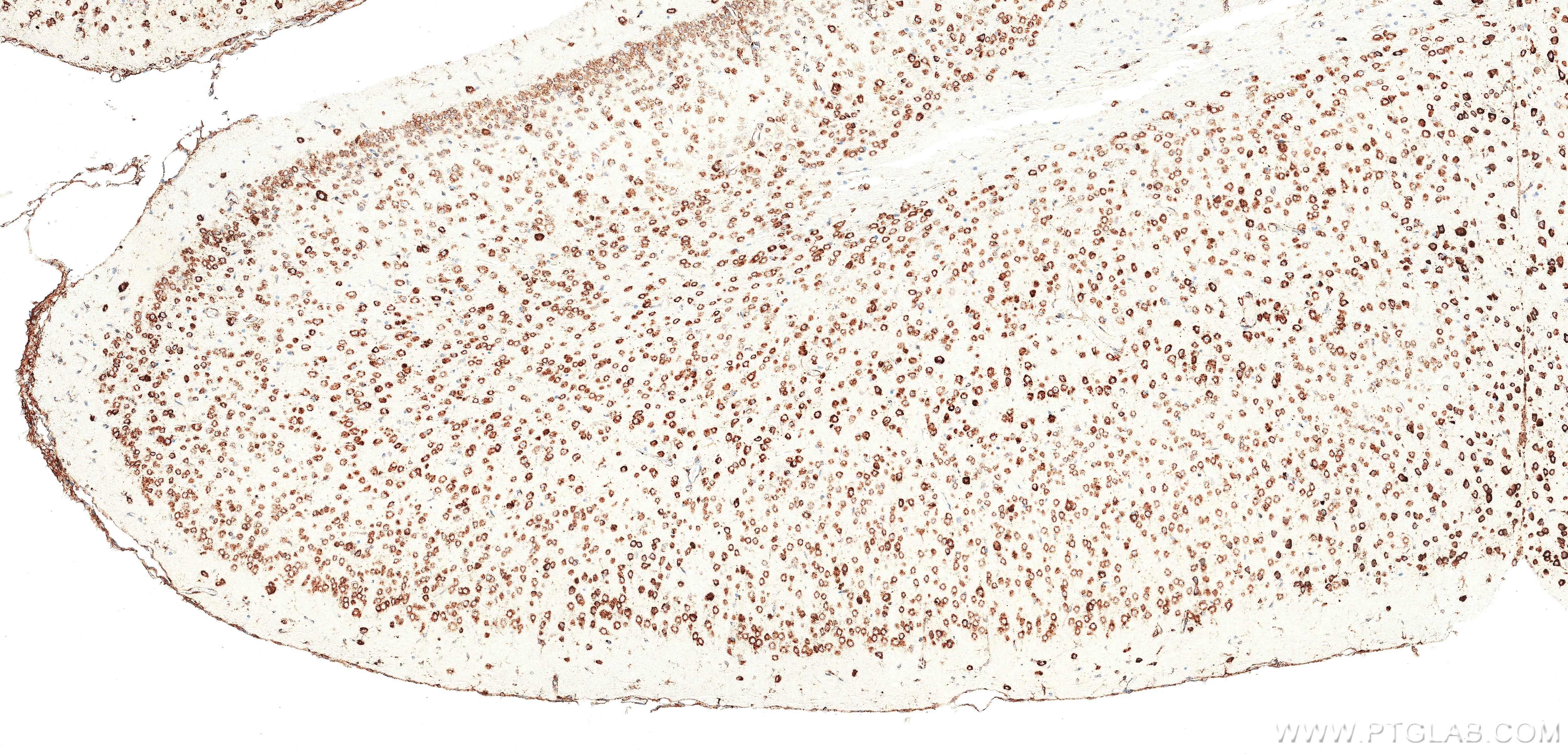 Immunohistochemistry (IHC) staining of mouse brain tissue using CKAP4 Recombinant monoclonal antibody (84485-5-RR)