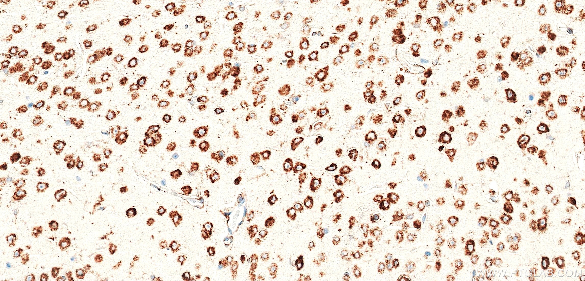 Immunohistochemistry (IHC) staining of mouse brain tissue using CKAP4 Recombinant monoclonal antibody (84485-5-RR)