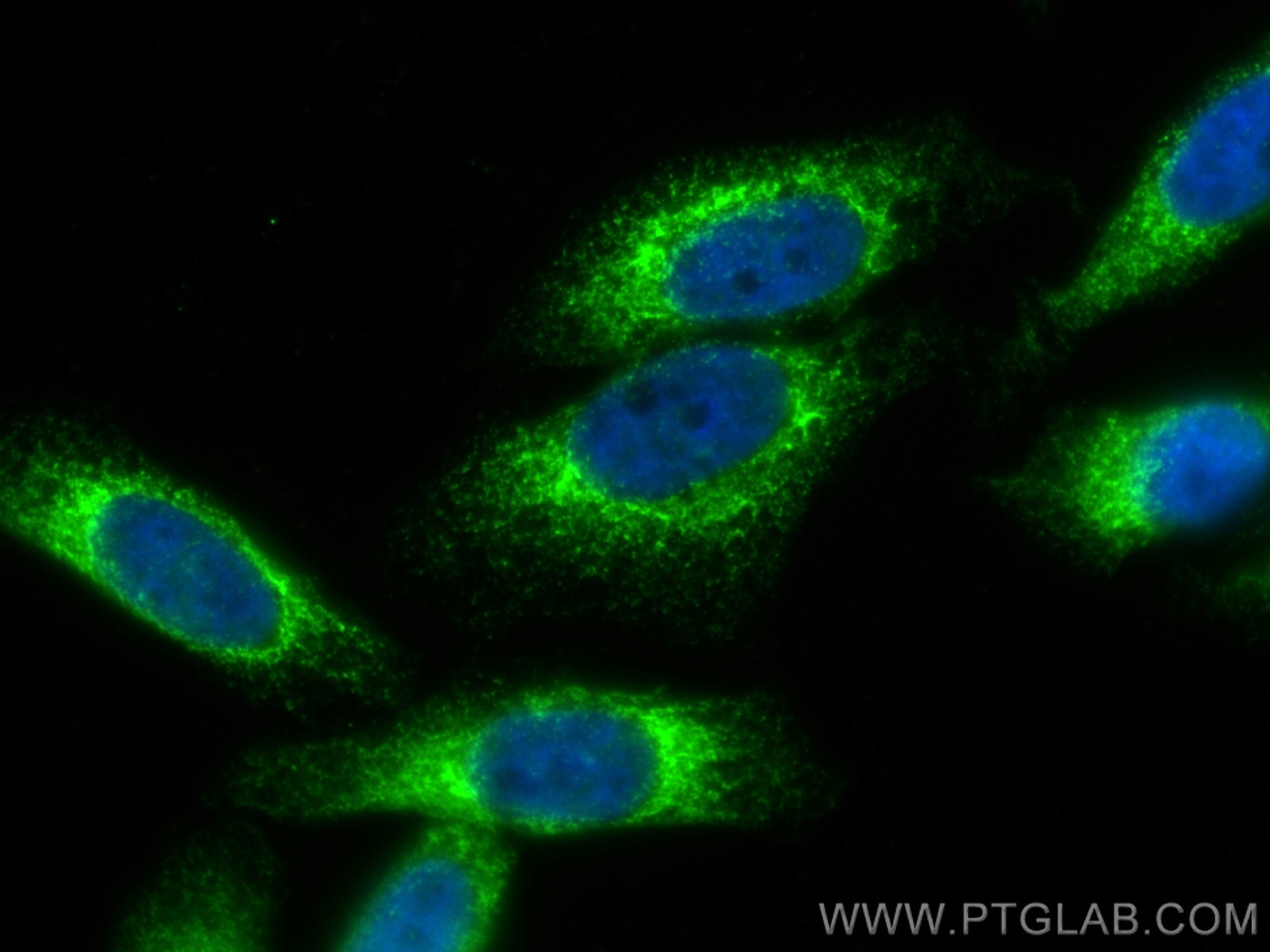 Immunofluorescence (IF) / fluorescent staining of HepG2 cells using CoraLite® Plus 488-conjugated CKAP4 Polyclonal ant (CL488-16686)