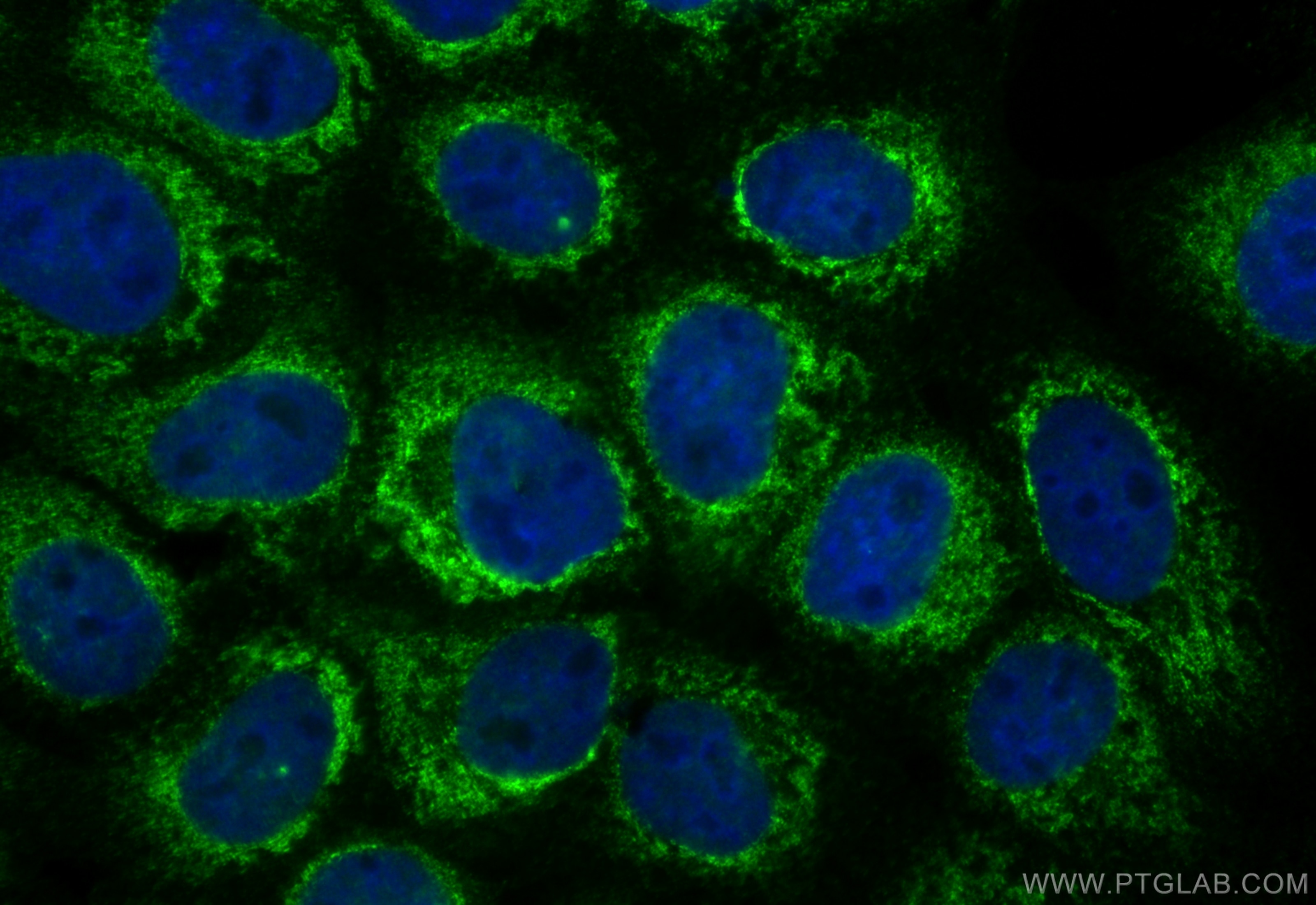 Immunofluorescence (IF) / fluorescent staining of A431 cells using CoraLite® Plus 488-conjugated CKAP4 Recombinant an (CL488-84485-4)