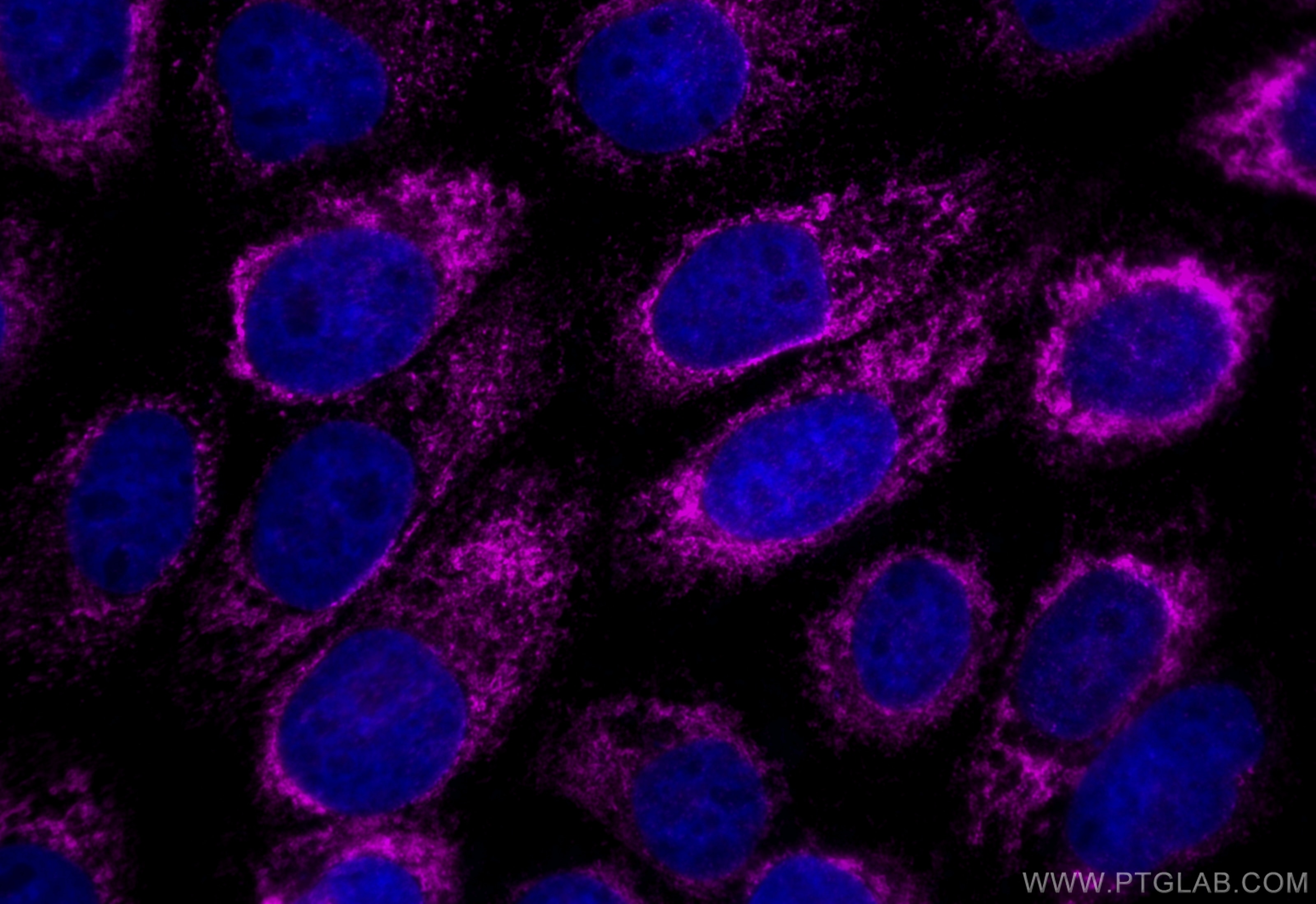 Immunofluorescence (IF) / fluorescent staining of A431 cells using CoraLite® Plus 647-conjugated CKAP4 Recombinant an (CL647-84485-4)