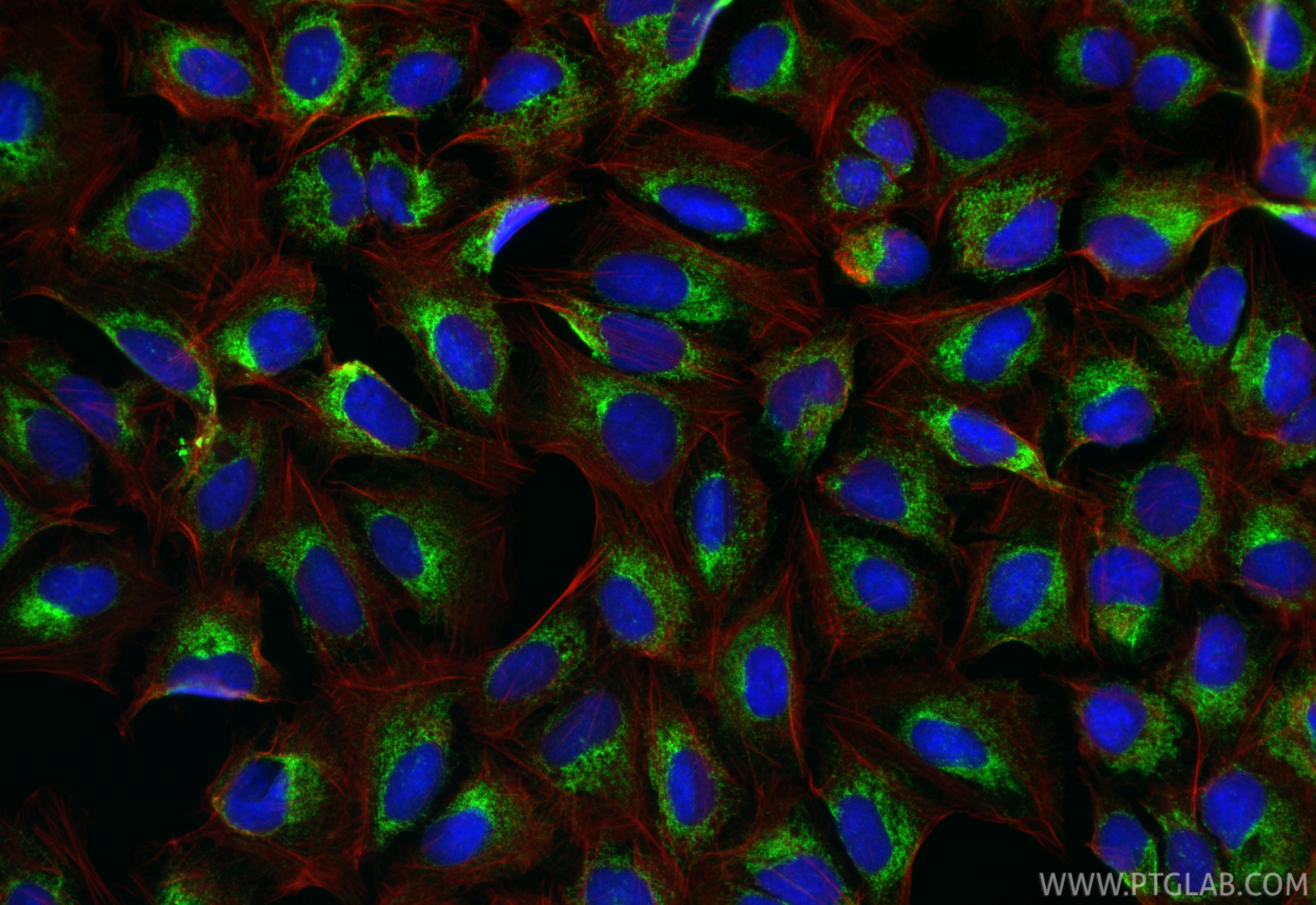 IF Staining of U2OS using RMX00054 Immunofluorescence (IF) / fluorescent staining of U2OS cells using Multi-rAb® CKAP4 Multi-Recombinant antibody (RMX00054)
