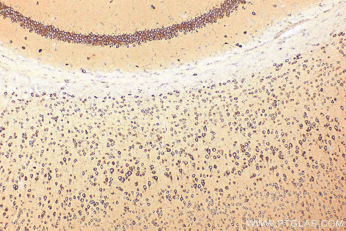 IHC staining of mouse brain using RMX00054 Immunohistochemistry (IHC) staining of mouse brain tissue using Multi-rAb® CKAP4 Multi-Recombinant antibody (RMX00054)