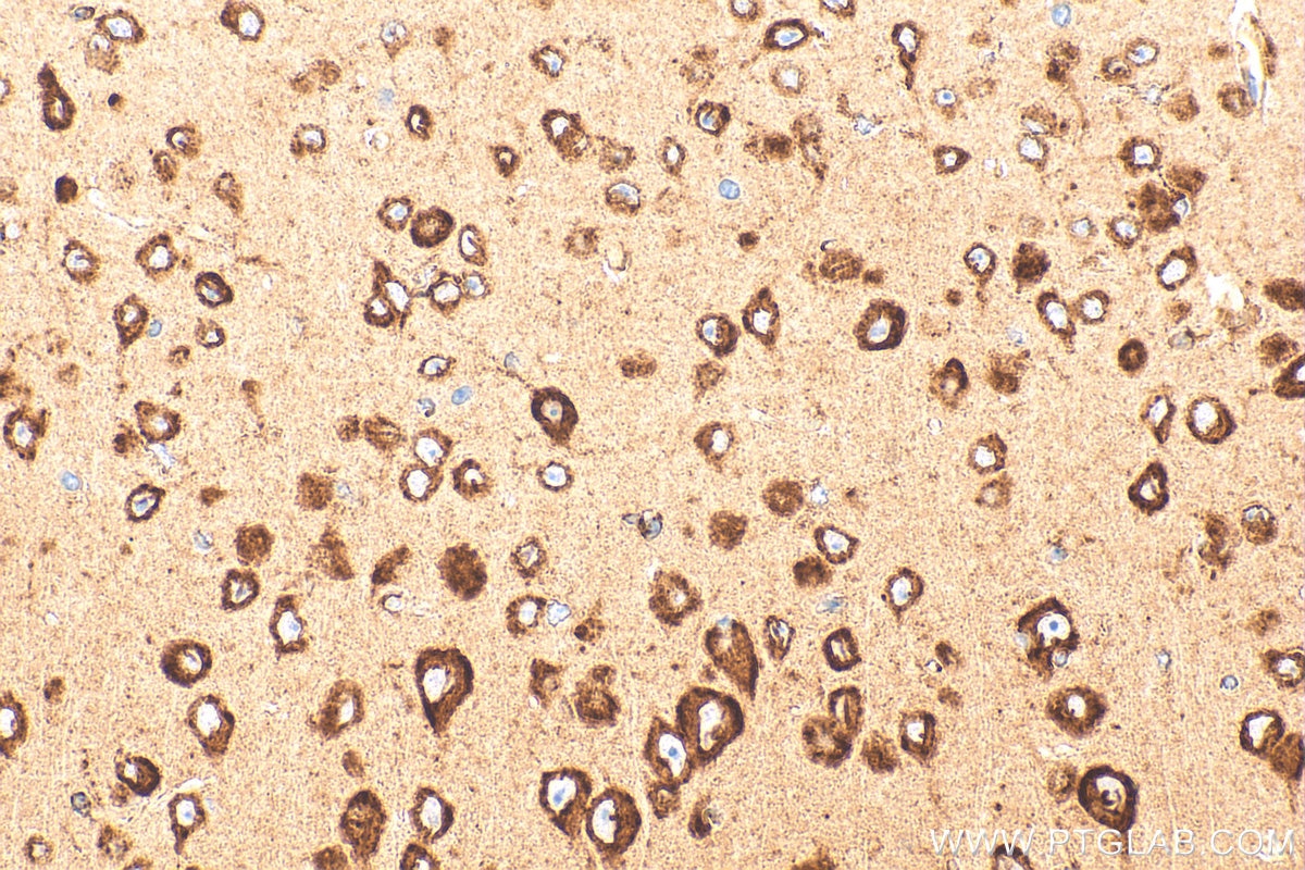 IHC staining of mouse brain using RMX00054 Immunohistochemistry (IHC) staining of mouse brain tissue using Multi-rAb® CKAP4 Multi-Recombinant antibody (RMX00054)
