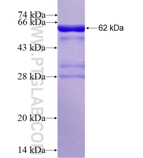 CKAP4 fusion protein Ag10019 SDS-PAGE