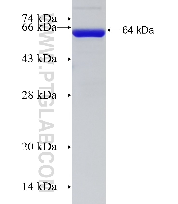 CKAP5 fusion protein Ag24875 SDS-PAGE