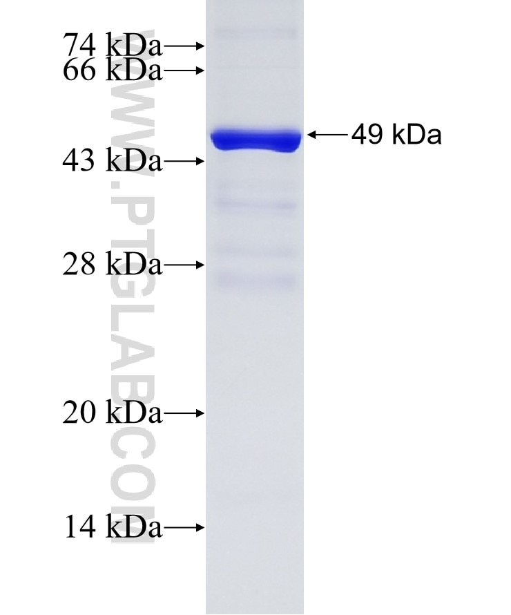 CKAP5 fusion protein Ag28770 SDS-PAGE