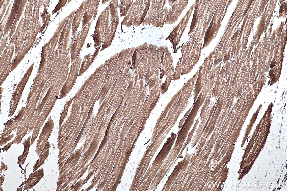 Immunohistochemistry (IHC) staining of mouse skeletal muscle tissue using CKB/CKM Polyclonal antibody (15137-1-AP)