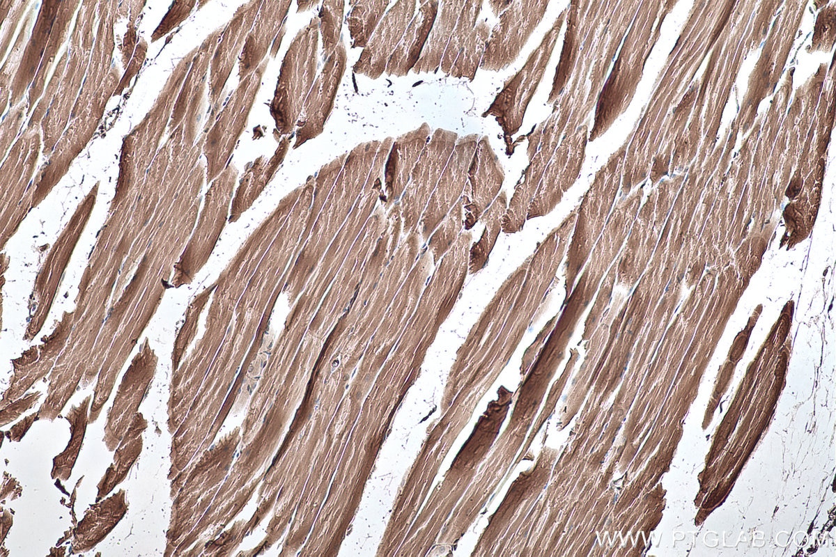 IHC staining of mouse skeletal muscle using 15137-1-AP