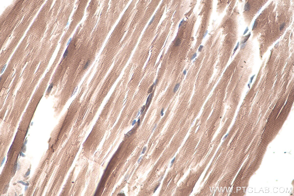 Immunohistochemistry (IHC) staining of mouse skeletal muscle tissue using CKB/CKM Polyclonal antibody (15137-1-AP)