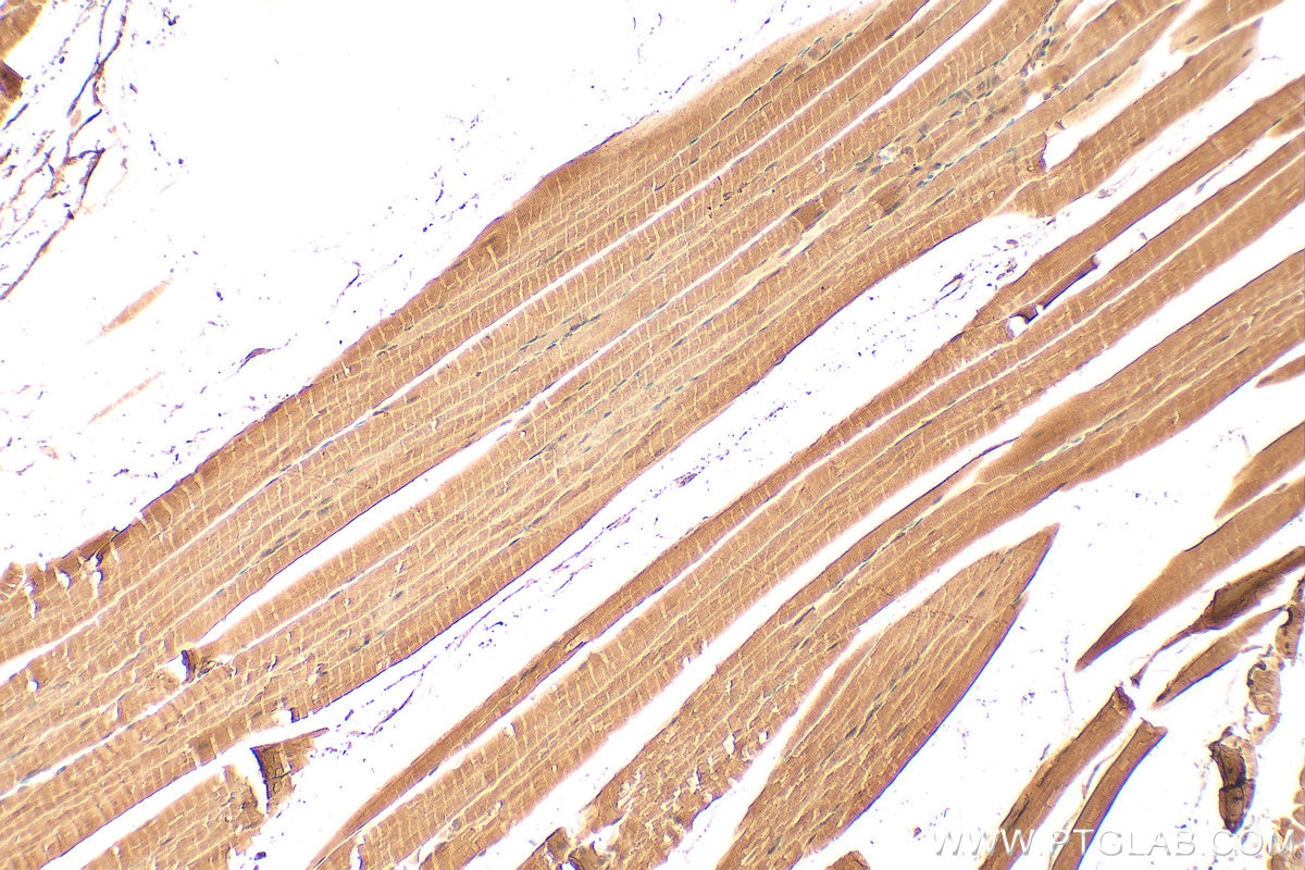 Immunohistochemistry (IHC) staining of mouse skeletal muscle tissue using CKB/CKM Polyclonal antibody (15137-1-AP)