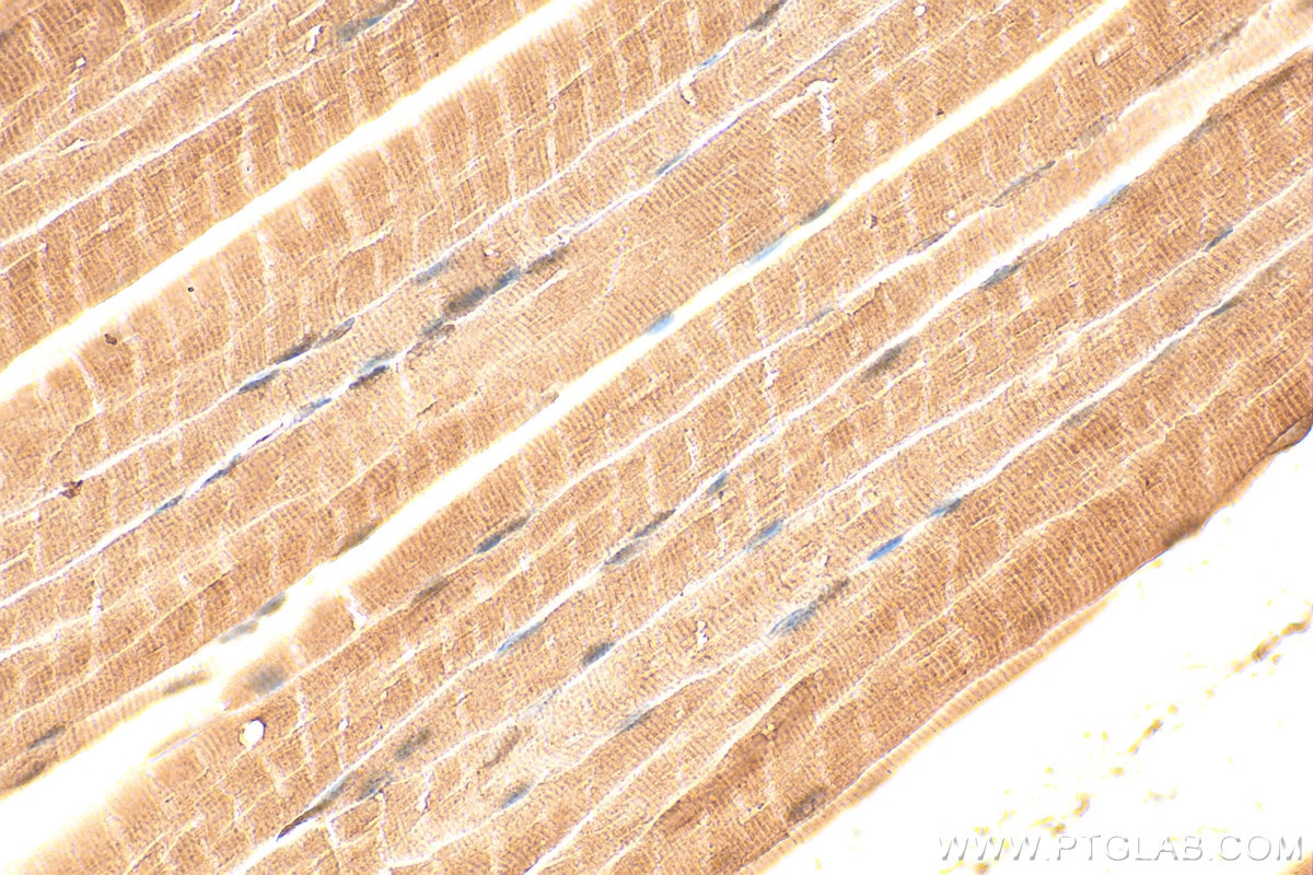 Immunohistochemistry (IHC) staining of mouse skeletal muscle tissue using CKB/CKM Polyclonal antibody (15137-1-AP)
